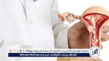 هل تحدث الأورام الليفية في الرحم بسبب نقص فيتامين د؟